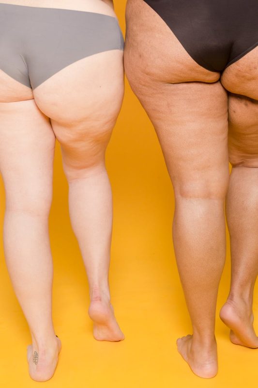 Faceless overweight multiracial models in panties on yellow background