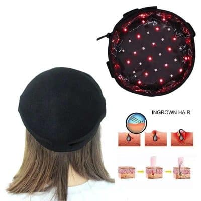 Alternative view of 70 LED Beads Therapy Helmet for Hair Regrowth and Loss Prevention