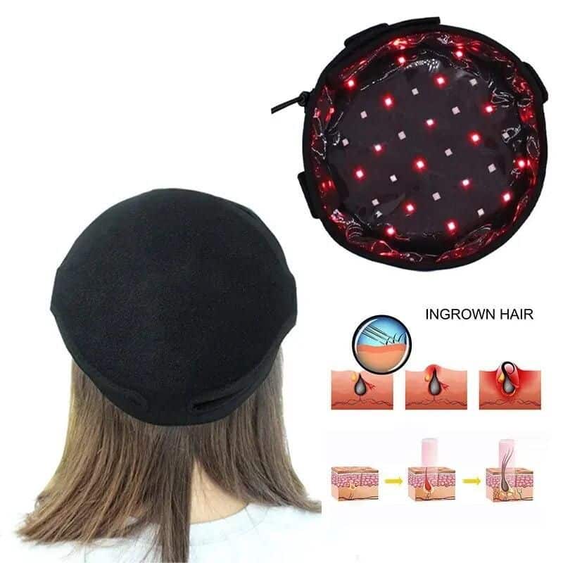 70 LED Beads Therapy Helmet for Hair Regrowth and Loss Prevention - Image 2