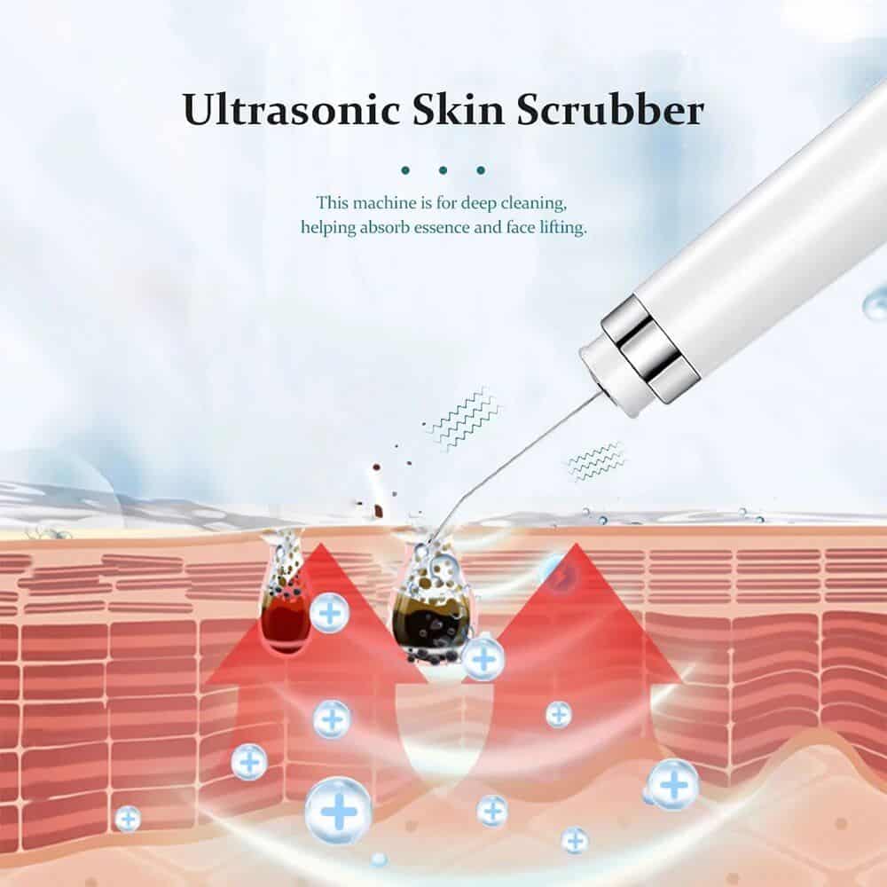 Ultrasonic Skin Scrubber - Image 3