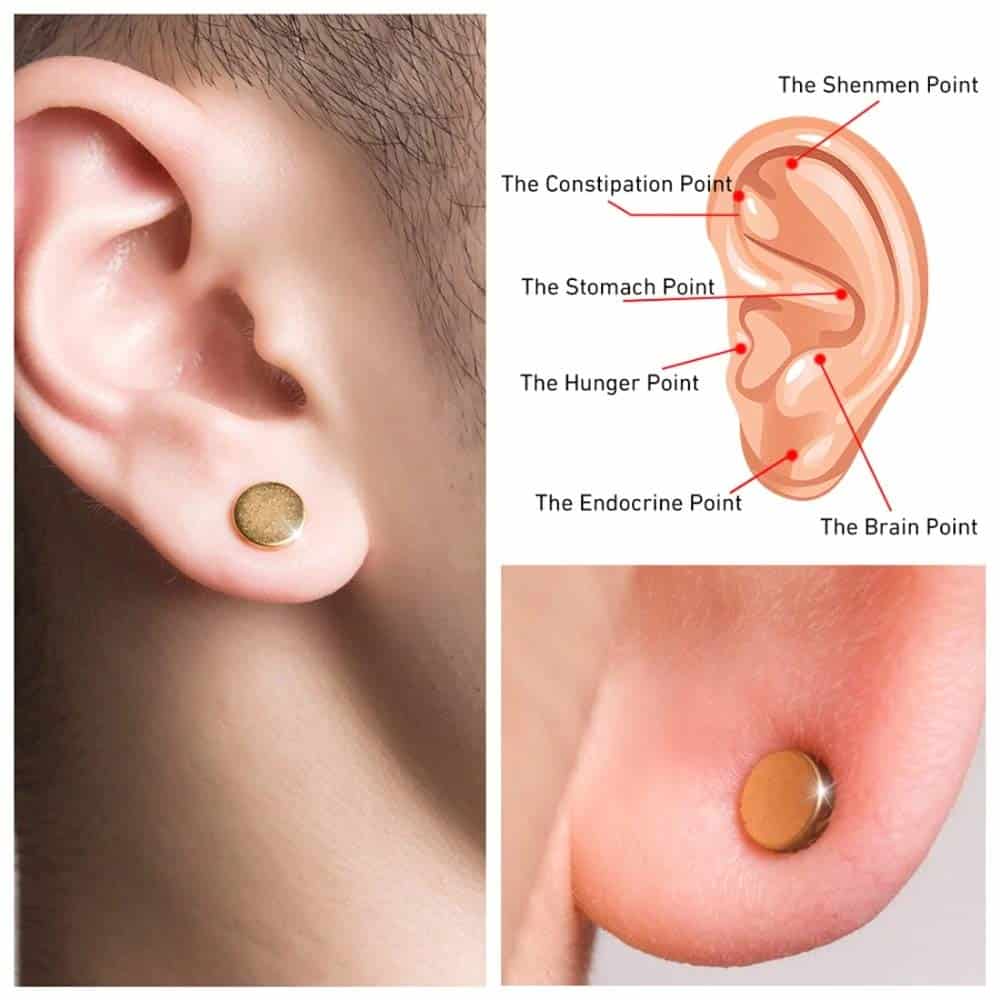 Quit Smoking Ear Magnet Patches - Image 4