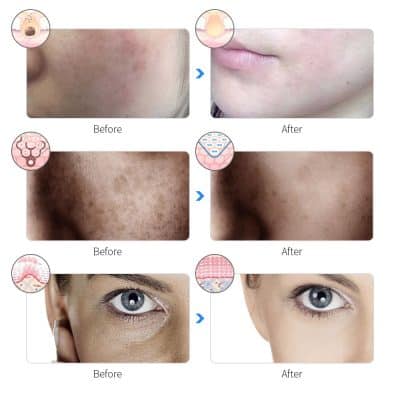 Clear skin transformation with Monalisa Medical's advanced treatment options for face and body. Achieve brighter, smoother, and healthier skin today.