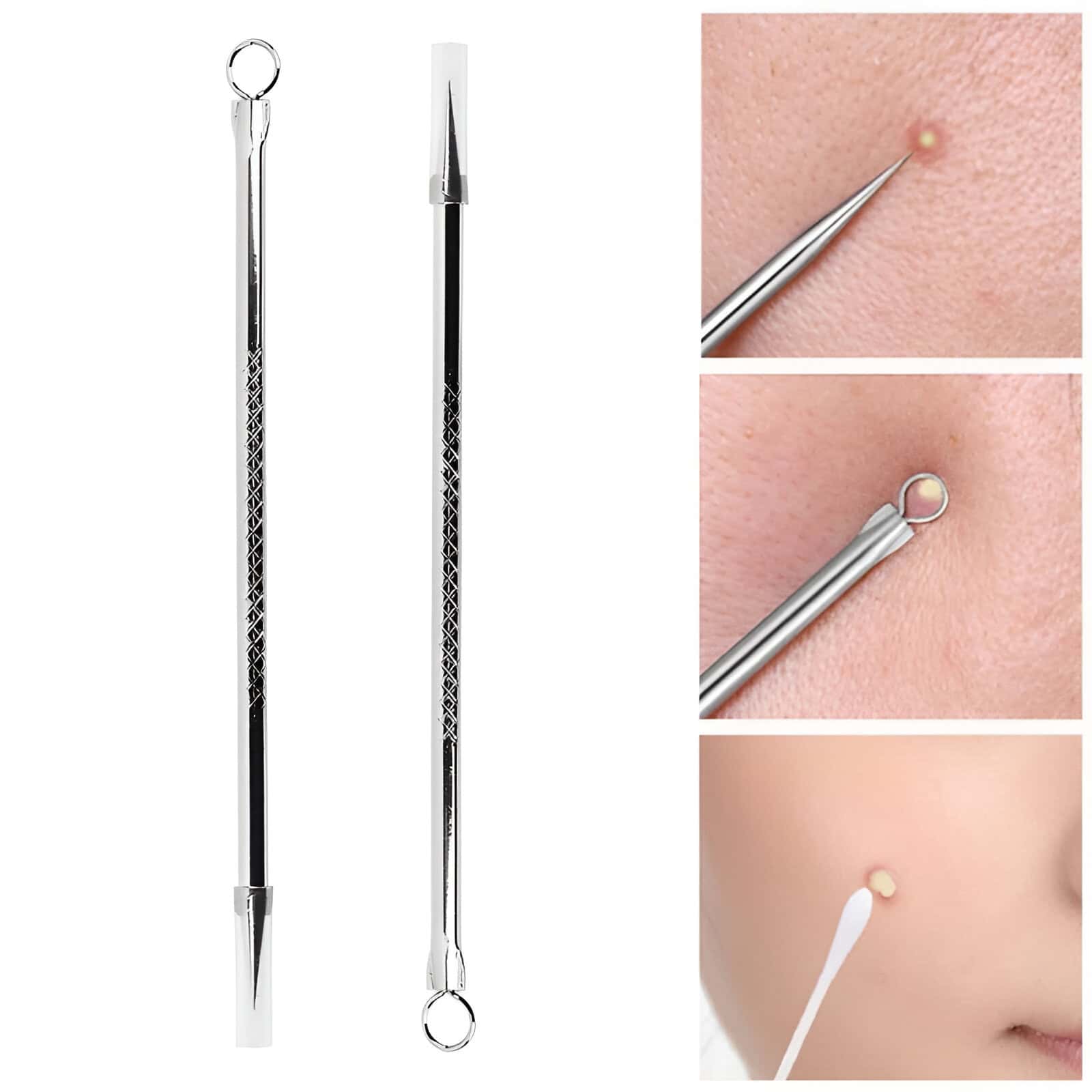 Sterile blackhead and acne comedone removal tools with precision tips, stainless steel double-ended extractor for facial pore cleaning and skin care.