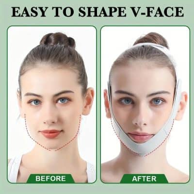 Clear skin and defined jawline transformation with V-face shaping device at Monalisa Medical Store. Achieve a contoured look effortlessly.