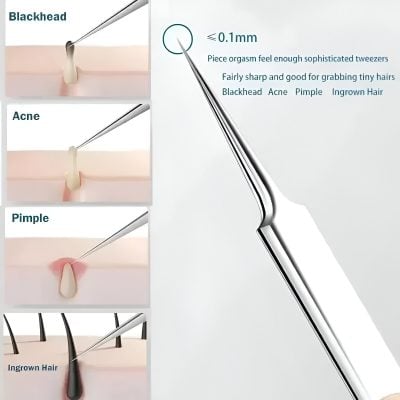Blackhead removal tweezers for precise extraction, suitable for acne, pimples, ingrown hairs, and blackheads, with a 0.1mm tip for delicate, effective skincare treatments at Monalisa Store.