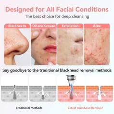Blackhead removal skincare treatment for all facial skin types, modern acne and blackhead clearing solution, Monalisa store opt, facial cleansing tools and products.