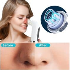 Precise skin care instrument demonstrating nose pore cleansing with ultrasonic technology for clearer skin.
