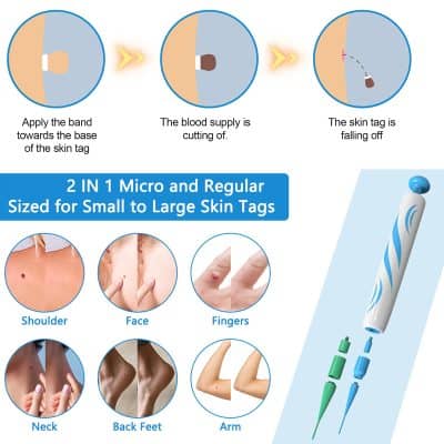 Apply the band towards the base of the skin tag, perfect for skin tag removal, effective for small to large skin tags.