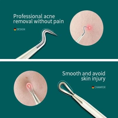 Professional acne removal instruments for painless, effective skin care. Perfect for clear, healthy skin with minimal discomfort.