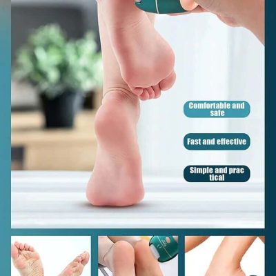Foot callus remover device for smooth, healthy feet.